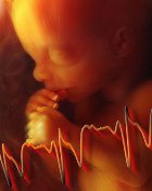 � �������� ������� ���� ���� ��������� �����������