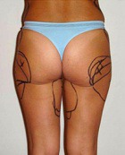 � ����� ����������