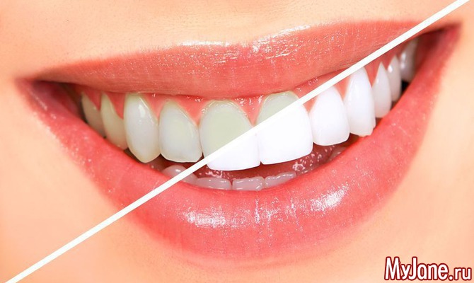 Возможно ли отбелить зубы в домашних условиях