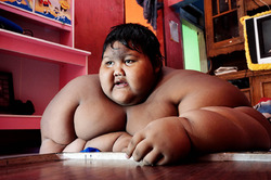Самому полному ребенку в мире удалось похудеть на сто килограммов